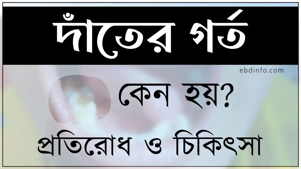 দাঁতের গর্ত সৃষ্টির কারণগুলো কি কি